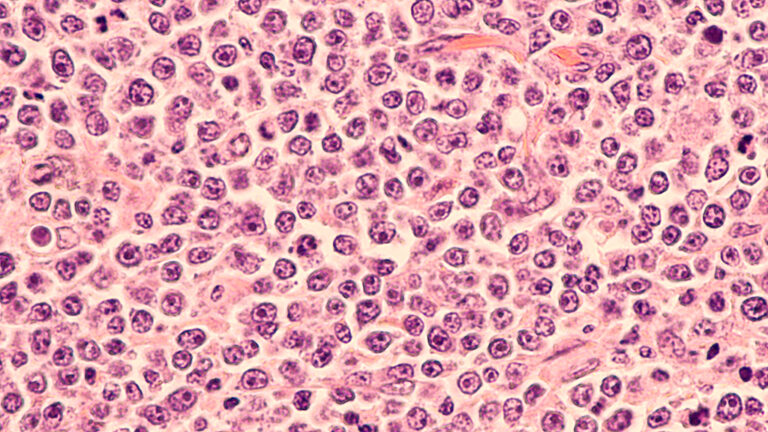 Microscopic image of stained cells showing numerous round, densely packed nuclei with varying sizes and shapes, typical of tissue histology under high magnification.