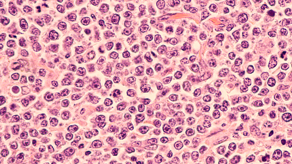 Microscopic image of stained cells showing numerous round, densely packed nuclei with varying sizes and shapes, typical of tissue histology under high magnification.