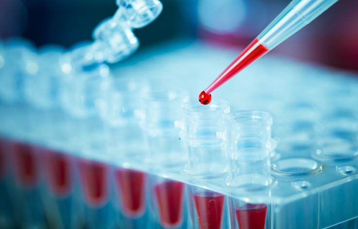 A red liquid drop from a pipette is being dispensed into a clear plastic test tube rack, with test tubes partially filled with red liquid in a laboratory setting.