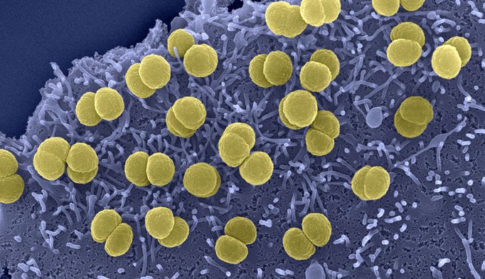 Coloured electron microscope image showing round, yellow bacteria clustered on a textured blue surface with many small, hair-like structures visible underneath the bacteria.