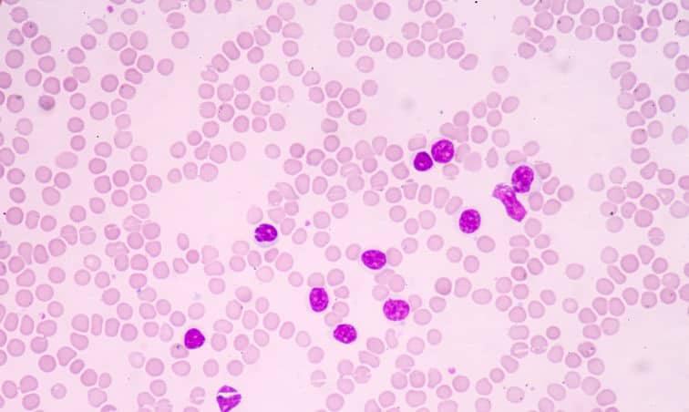 Microscopic image of human blood smear showing numerous round red blood cells and several purple-stained white blood cells scattered throughout the field. The background is pale pink.