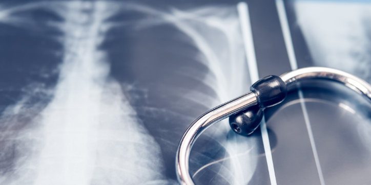 Close-up of a stethoscope resting on a chest X-ray image, showing the ribs and part of the spine, symbolising medical examination or diagnosis.