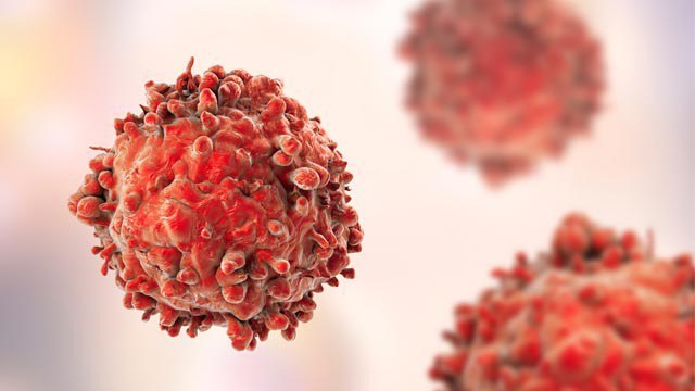 A close-up illustration of a red, spiky cancer cell with a blurred background showing two similar cells, highlighting the irregular surface and texture typical of cancerous cells.