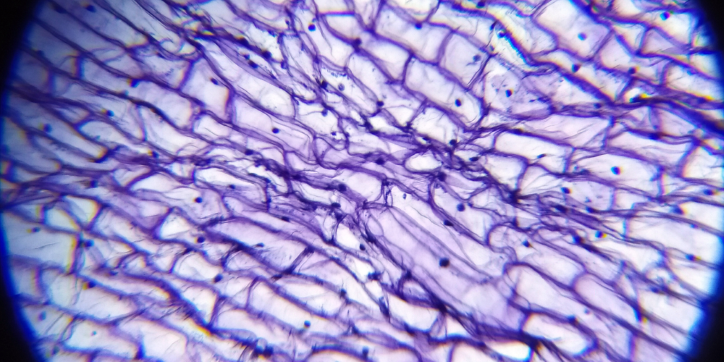 Microscopic view of plant cells showing rectangular shapes and purple-stained cell walls, with several dark dots scattered throughout the image.