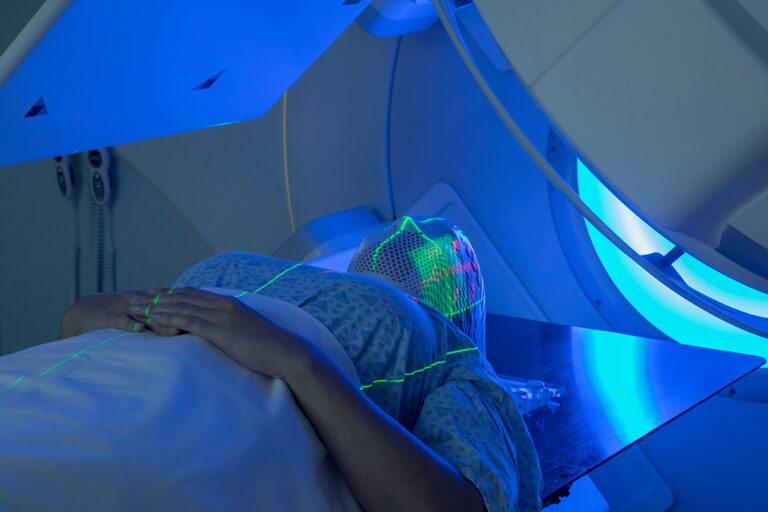 A patient lies on a table under a large machine with blue lights, wearing a mesh mask and hospital gown, prepared for a medical procedure such as radiotherapy. Green laser lines are projected onto their body.