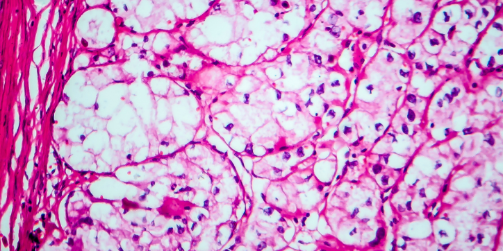 Microscopic image of pink and purple stained cells, showing large round cell structures with dark nuclei, possibly a tissue sample under high magnification.