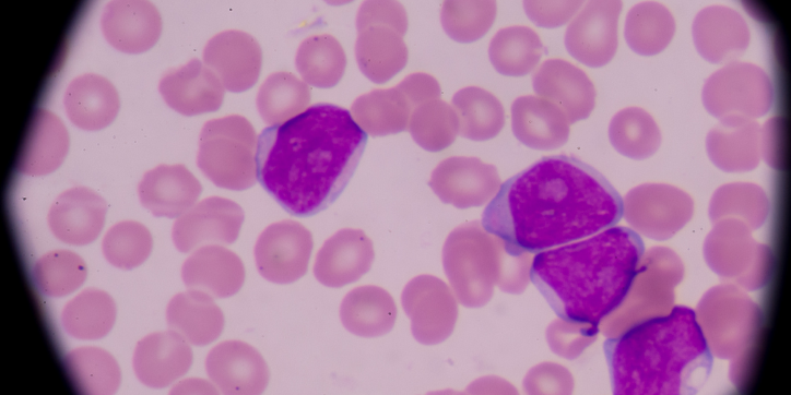 Microscope view of blood smear showing numerous pinkish-red blood cells and several larger purple-stained white blood cells scattered throughout the sample.