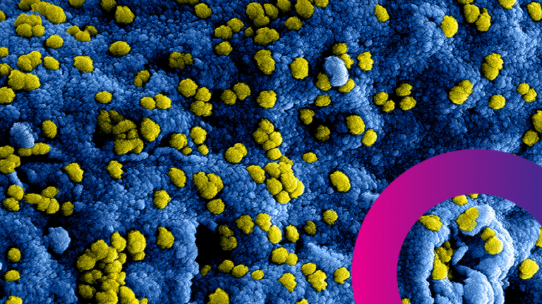 Microscopic view of yellow particles scattered on a textured blue surface, with a partial magenta-pink circular graphic in the lower right-hand corner.
