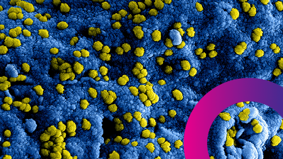 Microscopic view of yellow particles scattered on a textured blue surface, with a partial magenta-pink circular graphic in the lower right-hand corner.