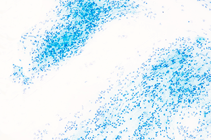 Understanding Q-TWiST in Oncology Treatments: Systematic Review
