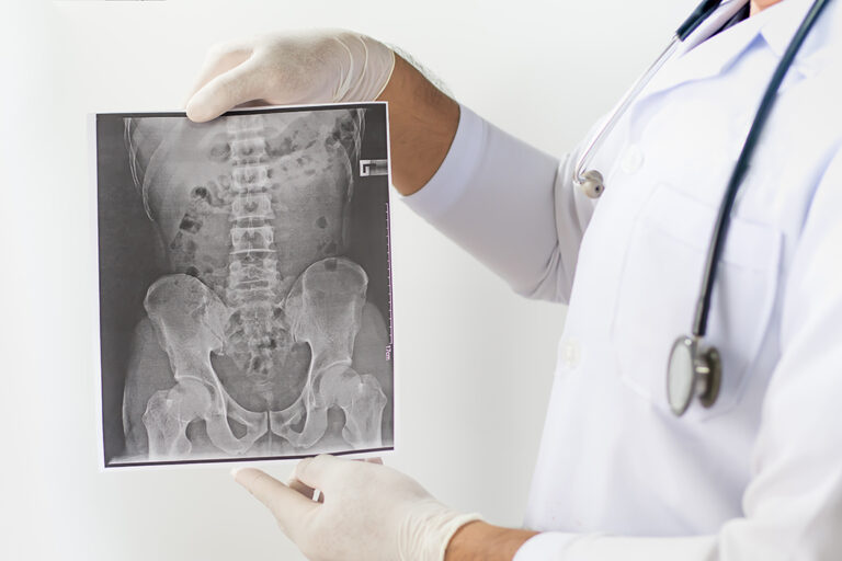 A doctor wearing gloves and a white coat holds up an X-ray image of a pelvis and lower spine, with a stethoscope around their neck.