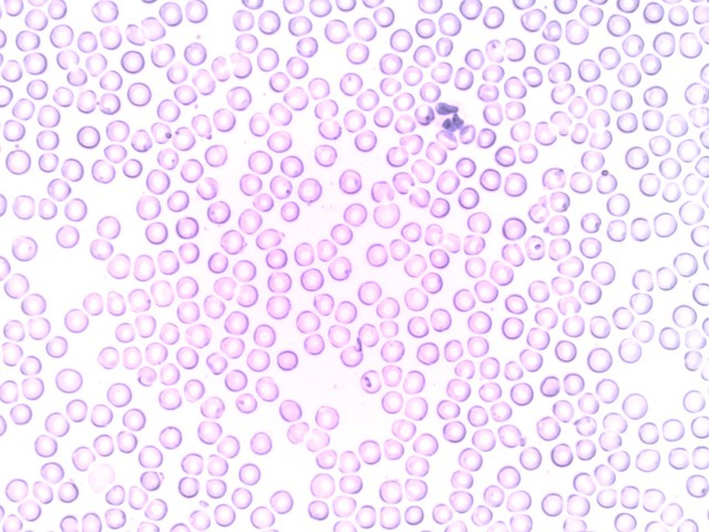 Microscope image showing numerous round, purple-stained cells scattered across a white background. Most cells are similar in size and shape, with a few darker, irregularly shaped cells among them.