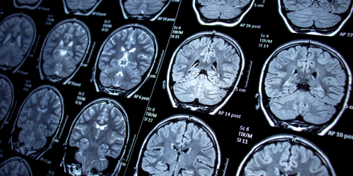 Multiple brain MRI scan images are displayed in a grid, showing cross-sectional views of the human brain with varying shades of grey and labelled medical text on the sides.