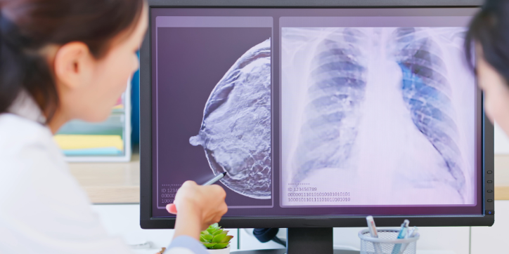 A doctor points at a breast X-ray on a computer screen next to a chest X-ray, explaining the images to a patient.