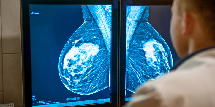A doctor examines two mammogram images displayed on monitors, focusing on breast tissue scans for signs of abnormalities.