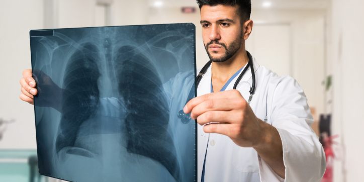 A doctor in a white coat and stethoscope examines a chest X-ray in a hospital corridor, focusing on the image of the lungs.