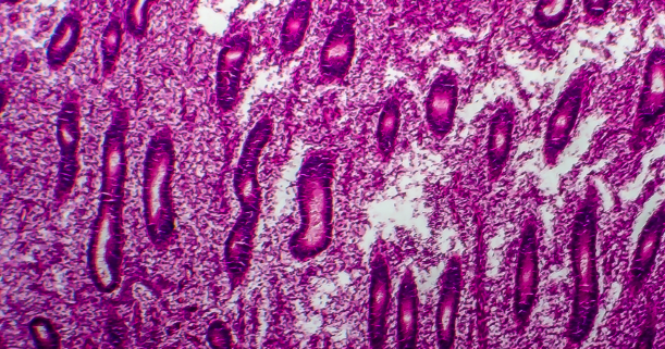Microscopic view of human stomach tissue stained pink and purple, showing elongated glandular structures and densely packed cells.