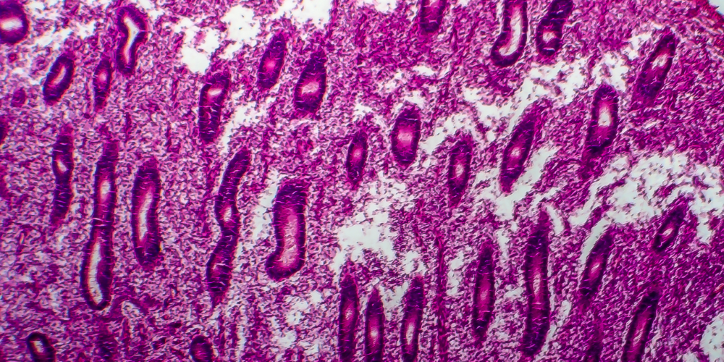 Microscopic image of tissue showing elongated, oval structures in purple and pink hues, with varying cell densities and textures throughout, suggesting a histological specimen.