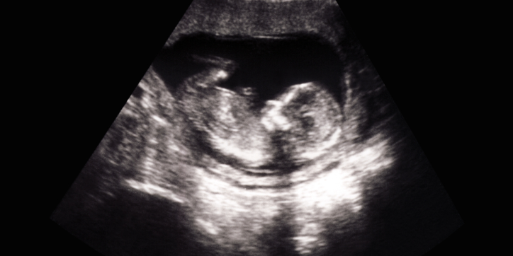 Ultrasound image showing a developing foetus inside the womb, with head, body, and limbs visible in black and white.