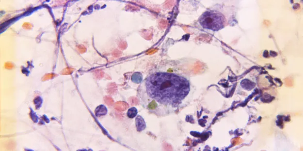 Microscopic view showing various cells, fibres, and nuclei in shades of purple, pink, and blue on a light background. Some cells appear large and round, with visible internal details.