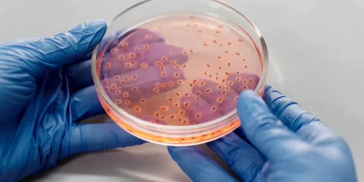Gloved hands hold a petri dish with a pinkish agar medium and multiple small bacterial colonies growing on its surface.