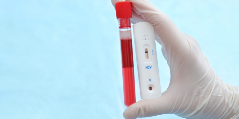 A gloved hand holds a blood sample vial and an HCV rapid test cassette showing a single line at C, indicating a negative hepatitis C result, against a light blue background.