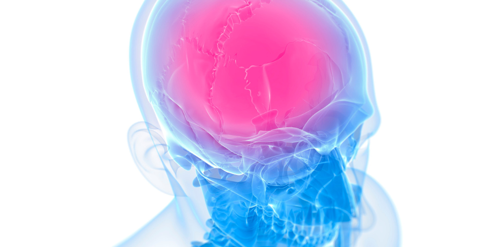 A transparent blue human skull with the top of the brain area highlighted in bright pink, illustrating pain or injury in the upper head region.