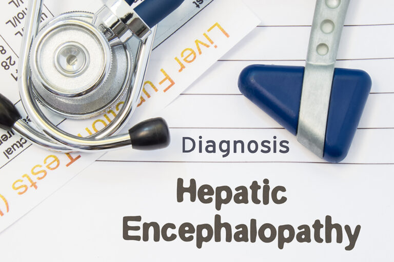 A stethoscope and reflex hammer rest on papers with the words Diagnosis and Hepatic Encephalopathy printed, indicating a medical diagnosis related to liver function.