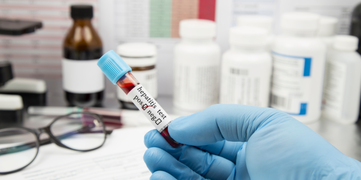 A gloved hand holds a blood sample tube labelled hepatitis test: positive. Medical bottles, paperwork, and a pair of spectacles are visible in the blurred background.