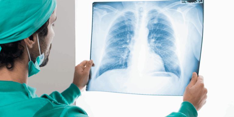 A healthcare professional in green scrubs examines a chest X-ray, holding it up to the light.