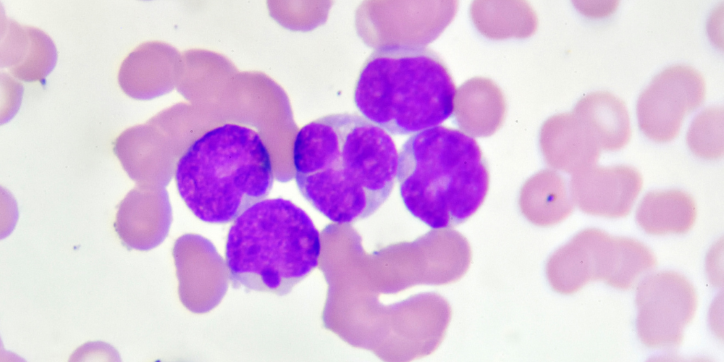 Microscopic image showing clusters of purple-stained cells with distinct nuclei among paler pink cells, likely representing white blood cells in a blood film.