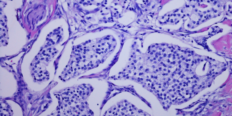 Microscopic view of stained tissue, showing clusters of purple-stained cells with visible nuclei, separated by thin, pink connective tissue strands.