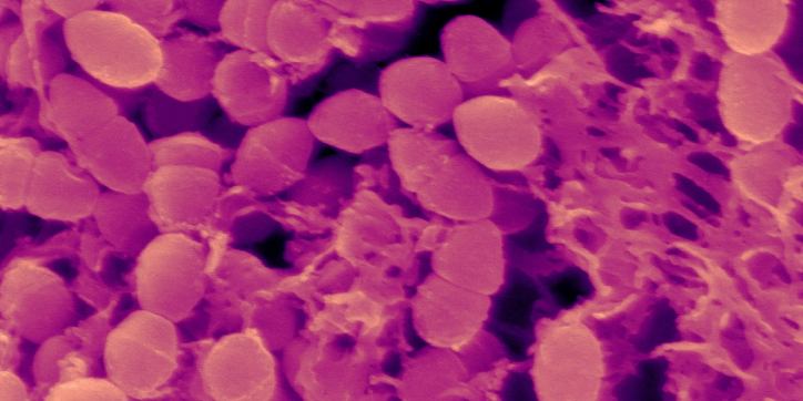 Close-up microscopic image of clusters of oval-shaped cells with a pink and purple colouration, showing cellular structure and texture.