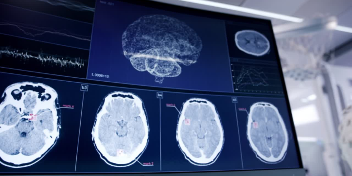 A monitor displays brain scans, including a 3D brain model and several cross-sectional MRI images, alongside graphs and data readings, in a clinical or laboratory setting.