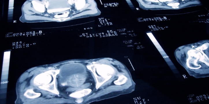 A close-up of several pelvic CT scan images displayed on a screen, showing cross-sectional views of the pelvic bones and organs with various medical annotations and scale markers.
