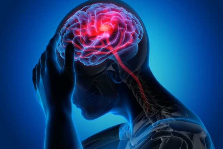 Illustration of a person holding their head, with a highlighted brain inside the skull showing red pain points, suggesting a headache or neurological issue, against a blue background.