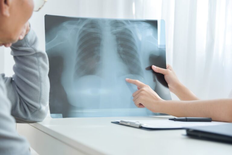 A doctor shows a chest X-ray to a patient, pointing at a specific area on the image. The patient appears to be listening attentively. A clipboard and pen are on the desk.