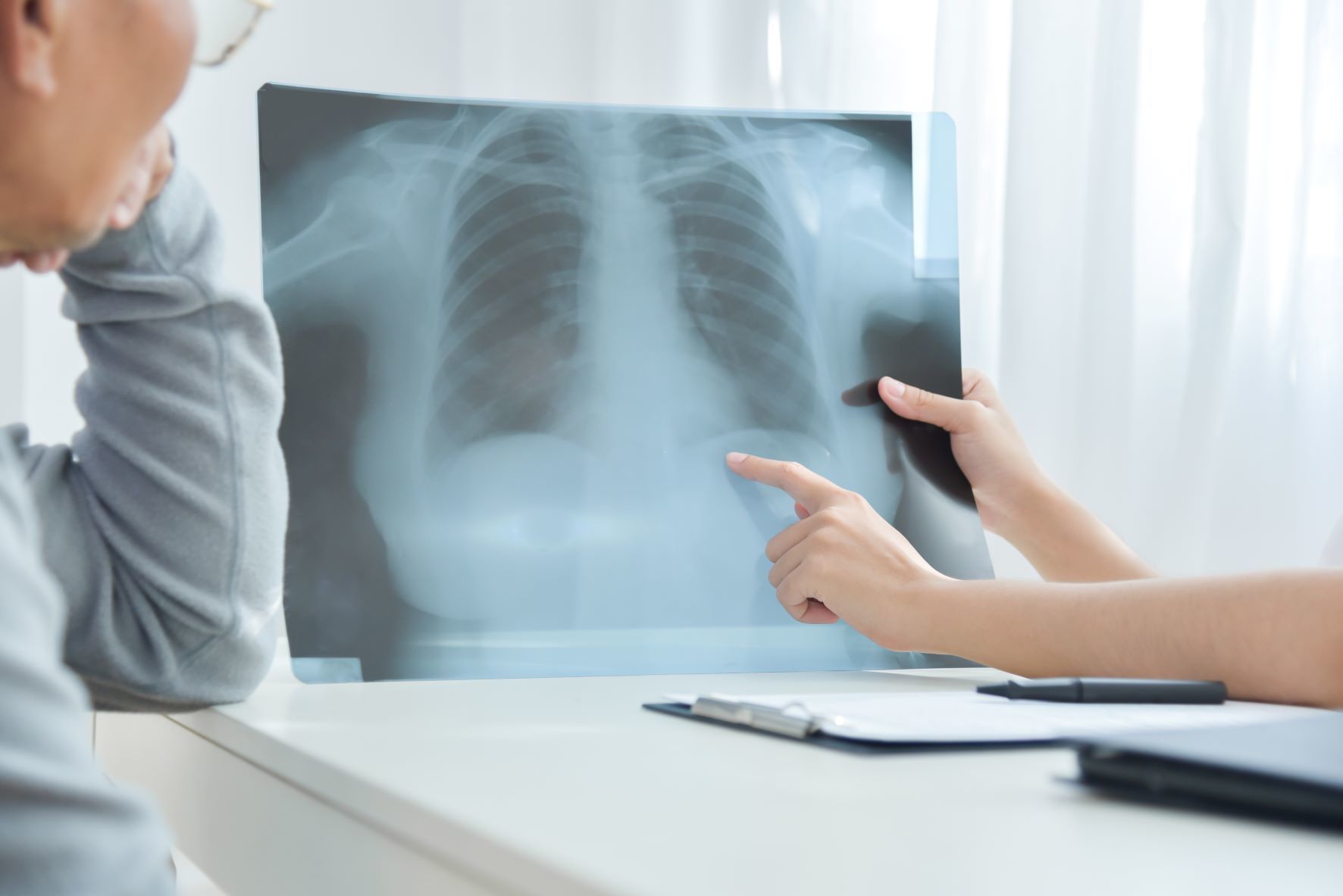 A doctor shows a chest X-ray to a patient, pointing at a specific area on the image. The patient appears to be listening attentively. A clipboard and pen are on the desk.