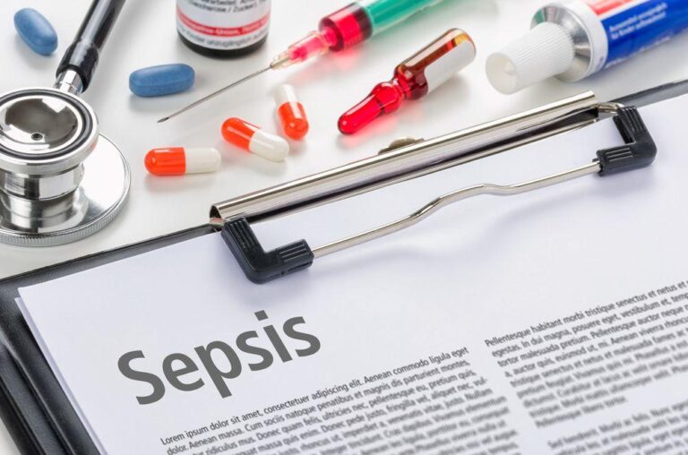 A clipboard with a document titled Sepsis surrounded by tablets, a stethoscope, a syringe, a vial, and a tube of ointment, illustrating a medical context.