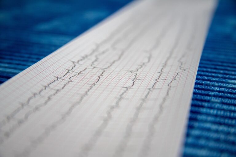 A close-up of a strip of paper with black wavy lines, likely from a medical monitor or seismograph, placed on a textured blue surface.